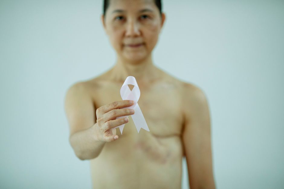 Technik przygotowuje kobietę do mammografii w pracowni badań obrazowych.