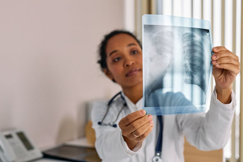 Lekarz analizuje zdjęcie rentgenowskie klatki piersiowej na negatoskopie w jasnym gabinecie diagnostycznym.